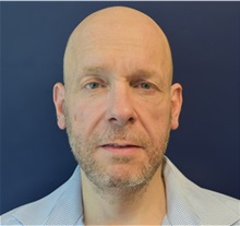 Facelift After Photo by Richard Reish, MD, FACS; New York, NY - Case 32688