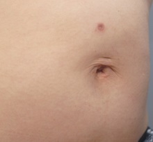 General Reconstruction After Photo by Ellen Mahony, MD; Westport, CT - Case 49622